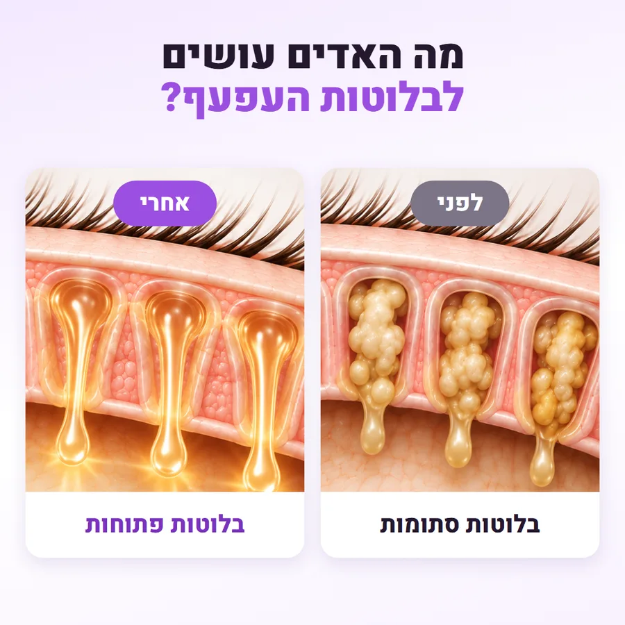 בלוטות העפעף לפני ואחרי